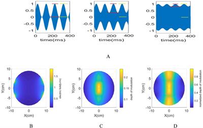 Neuromodulation effect of temporal interference stimulation based on network computational model